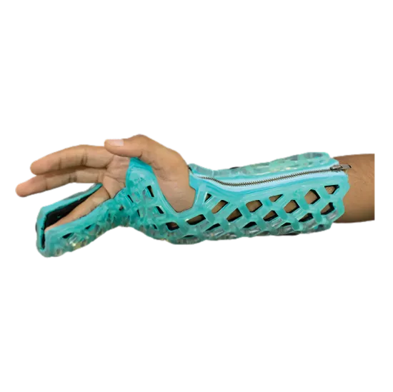 Picture of FlexiCast Ulnar Gutter Immobilizer